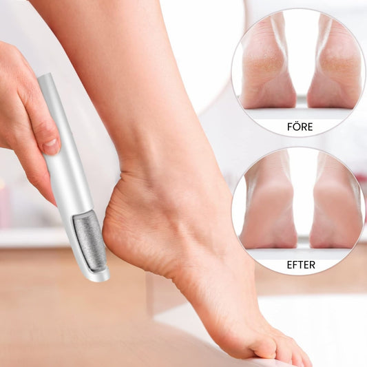 CalluSonic™ Professionell Elektrisk Förhårdnadsborttagare